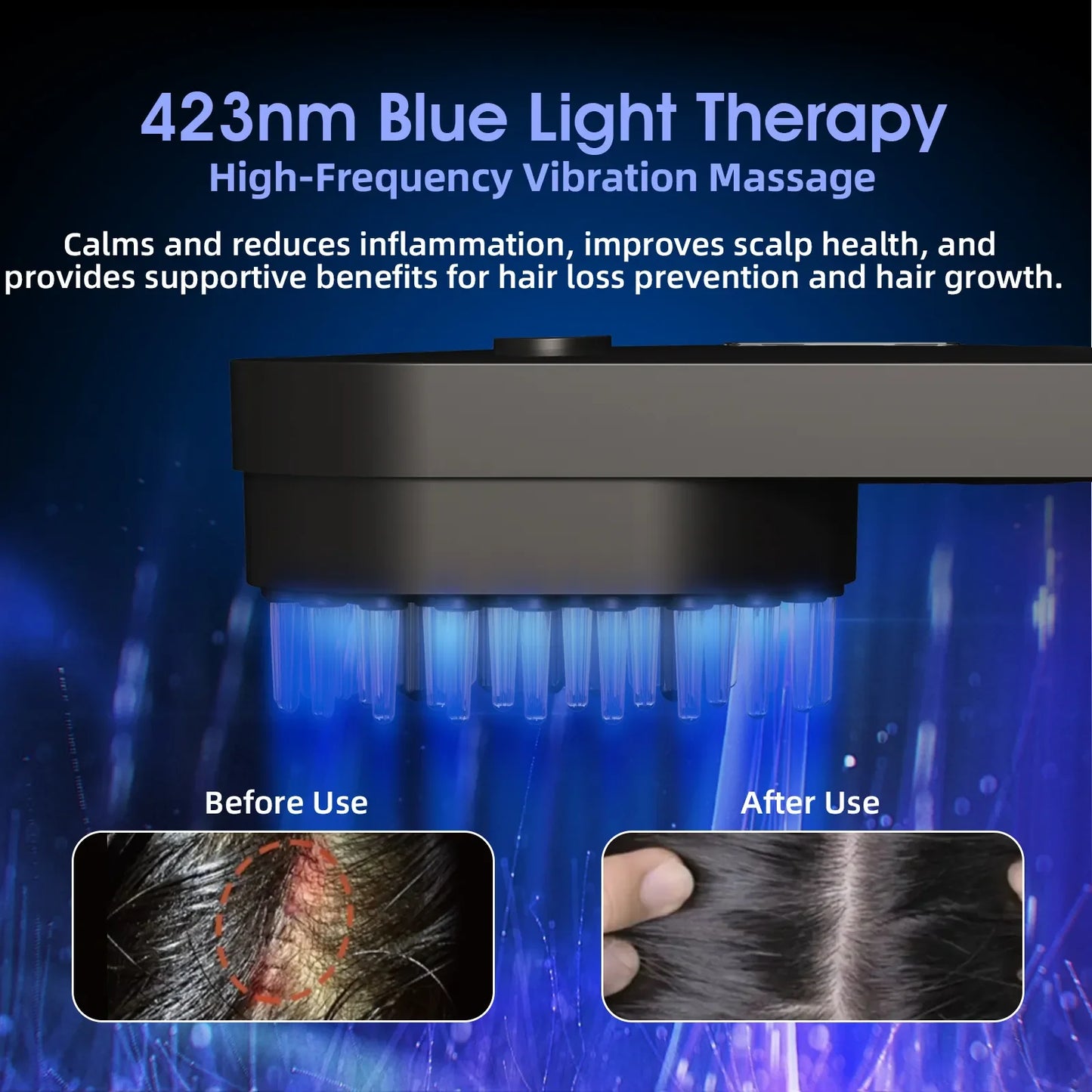 Electric Salon Scalp Care Hair Growth Comb LED Red Light Vibration Massage Comb Device